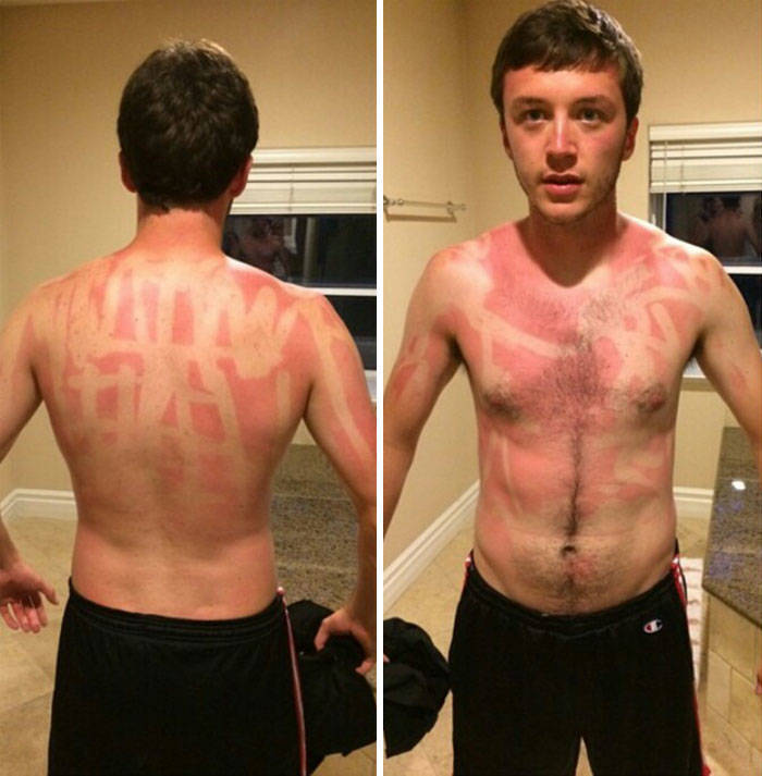 Never Forget Sunscreen!