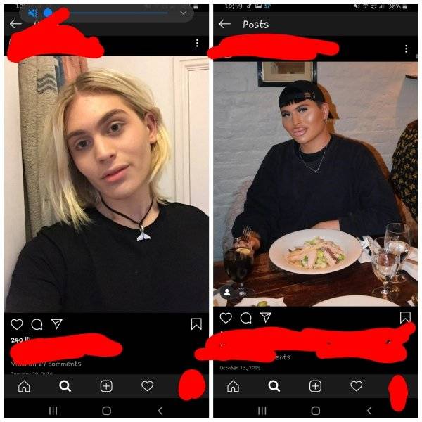 Plastic Surgery Is DEFINITELY Not For Everyone…