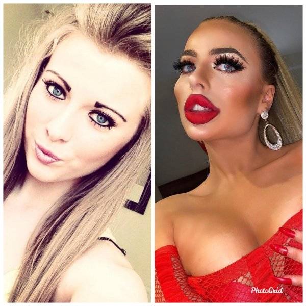 Plastic Surgery Is DEFINITELY Not For Everyone…