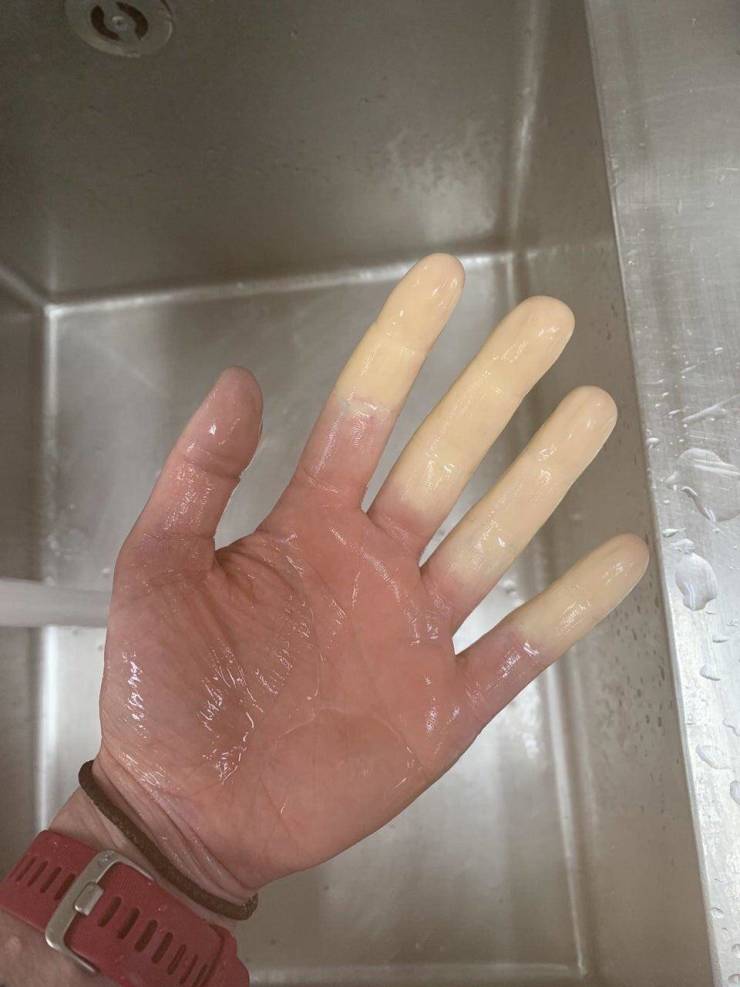 Pics That Are So Poignant And Fascinating