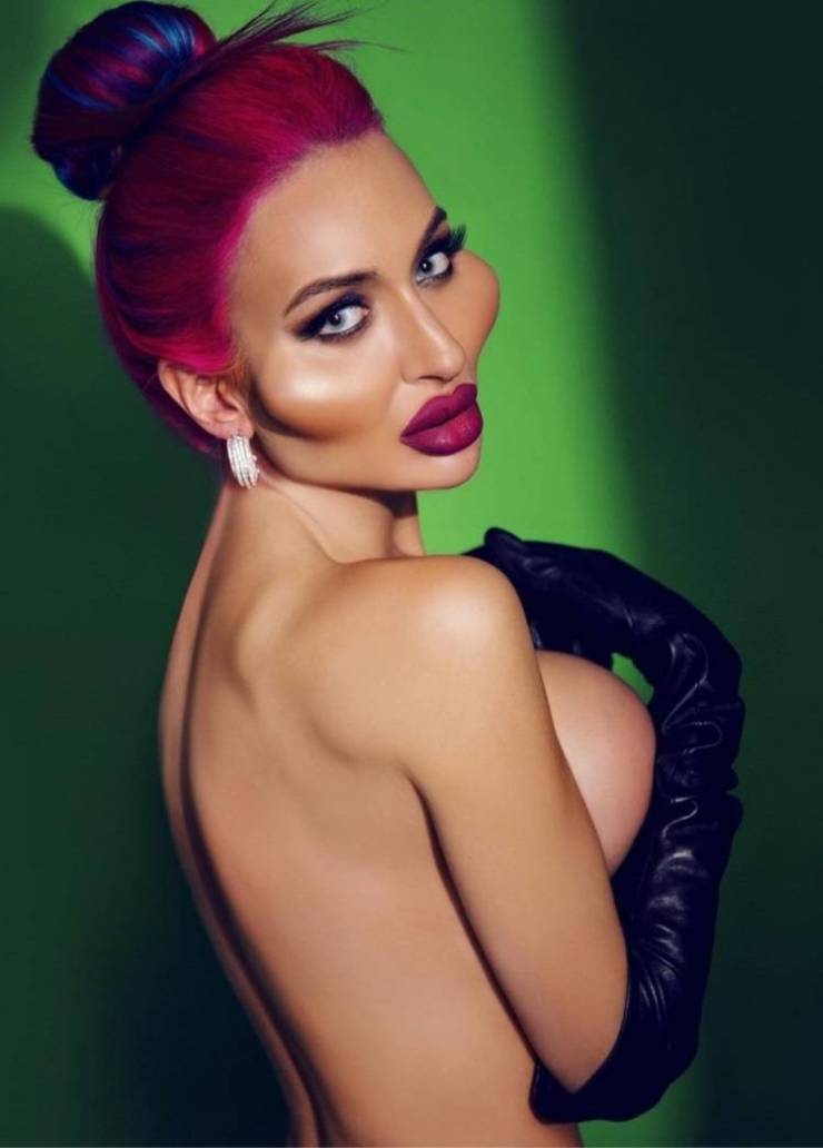 Before And After “Beauty” Fillers…