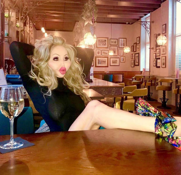 When Plastic Surgery Goes Too Far