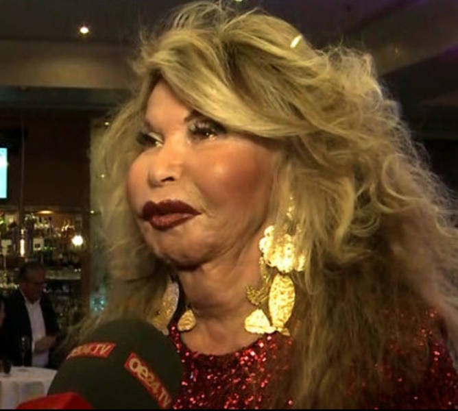 When Plastic Surgery Goes Too Far