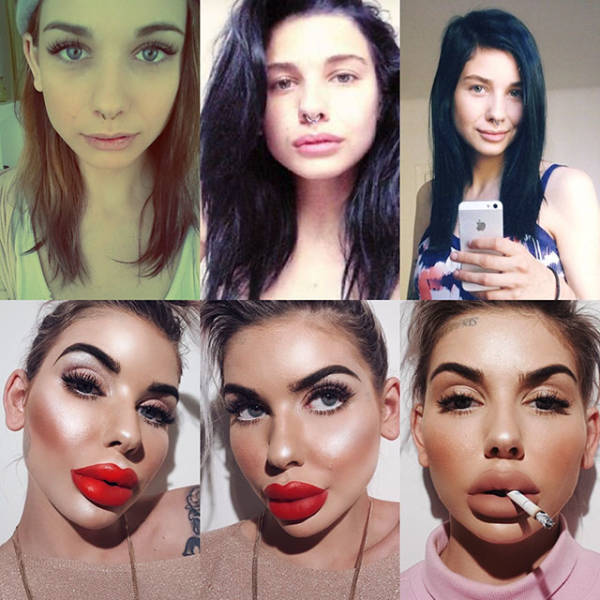 When Plastic Surgery Goes Too Far