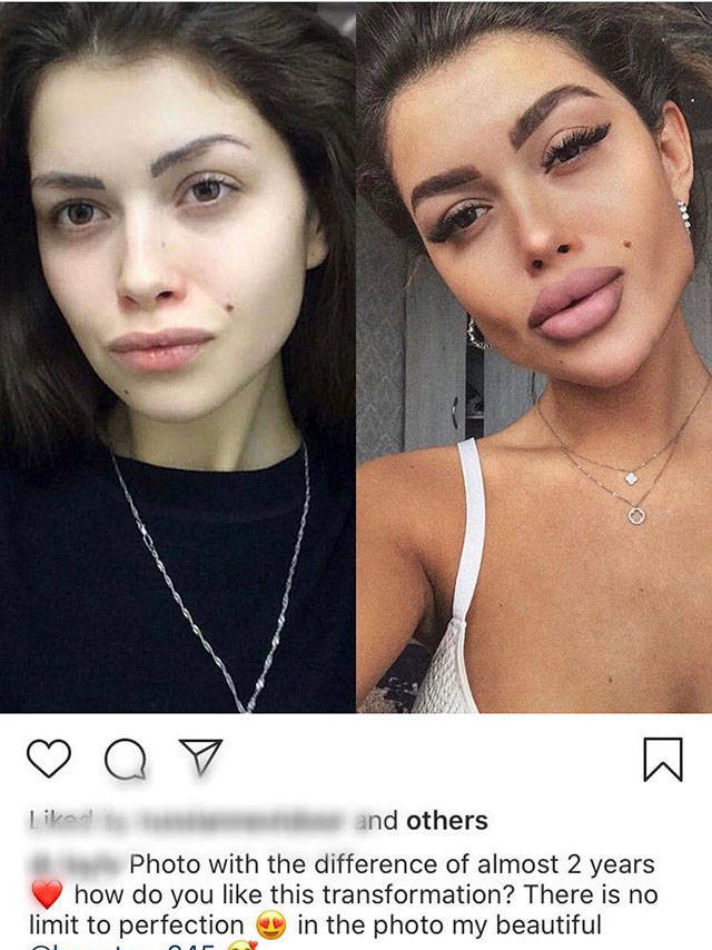 When Plastic Surgery Goes Too Far
