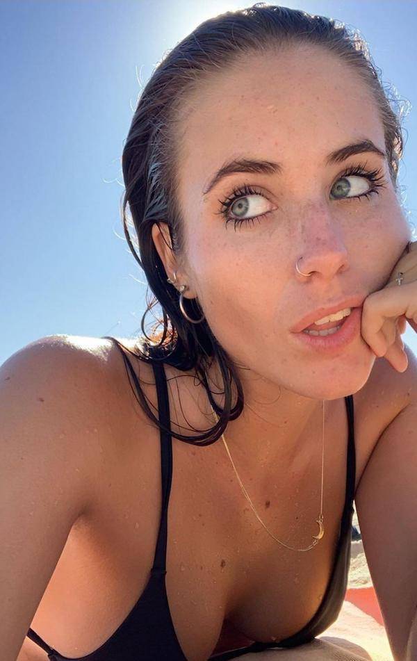 The Charm Of Freckled Faces