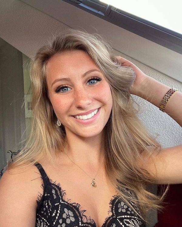 The Charm Of Freckled Faces