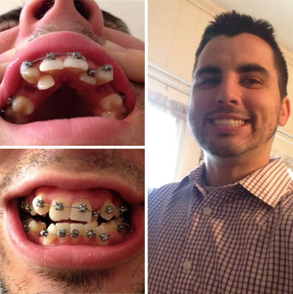 Before And After Combinations Can Be Pretty Mind-Blowing