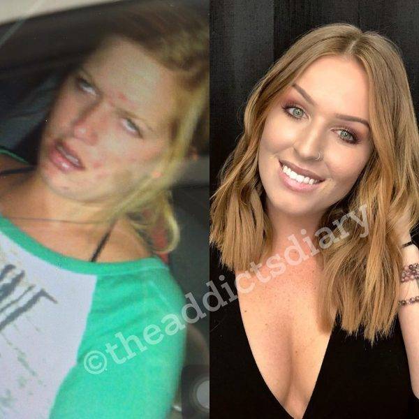 How Drug Addicts Transform After Getting Clean