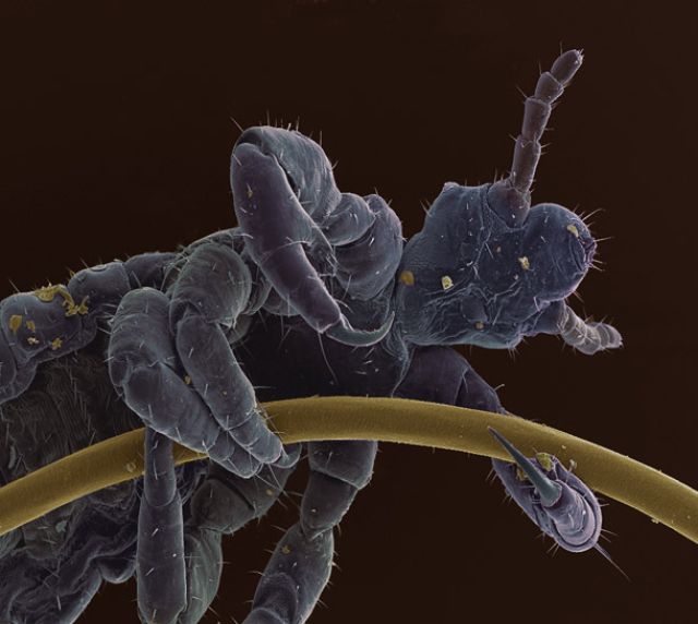 Amazing Scanning Electron Microscope Pictures
