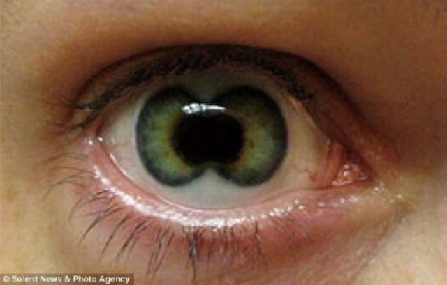 Eerie Eyeball Covers