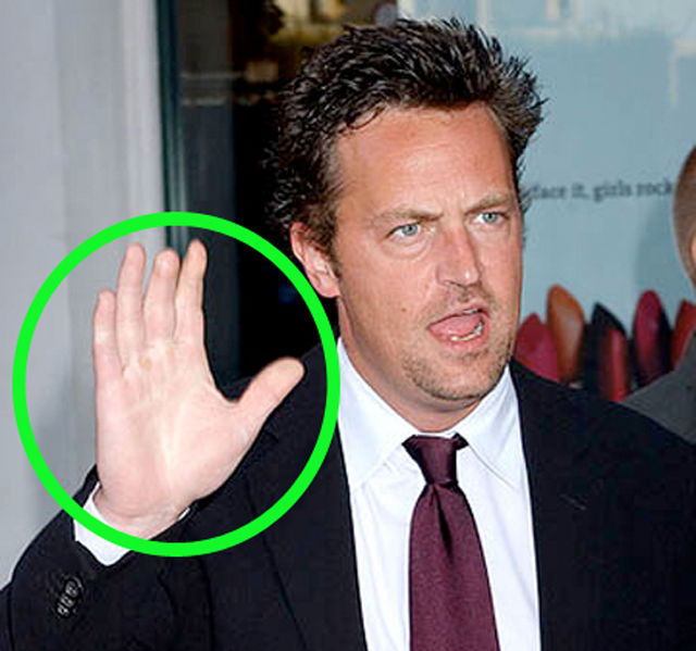 Celebs Have Imperfections Too!