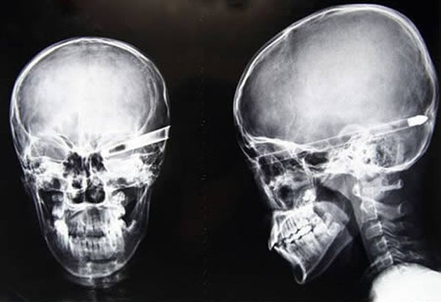 Real X-Rays That Will Shock and Astound You