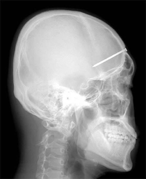 Real X-Rays That Will Shock and Astound You