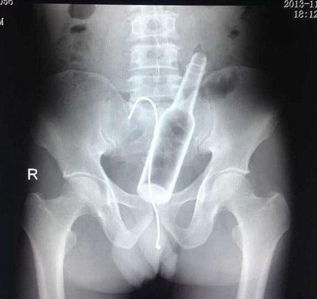 Real X-Rays That Will Shock and Astound You