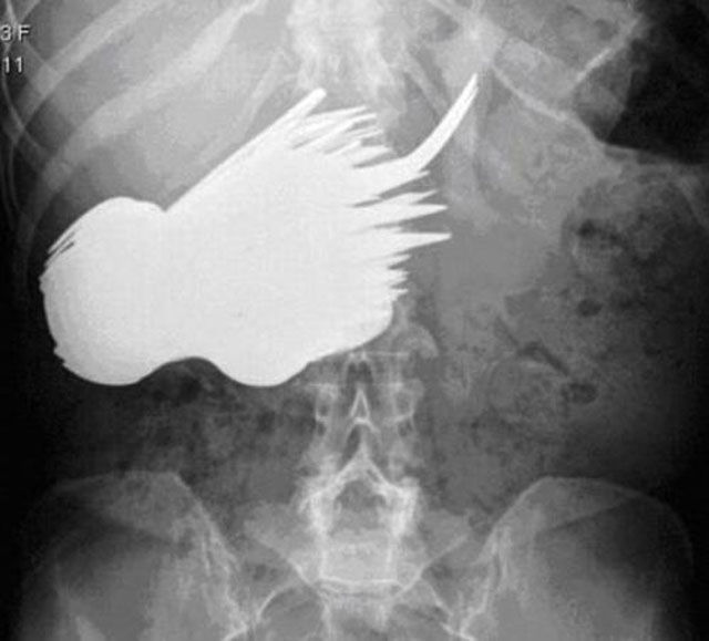 Real X-Rays That Will Shock and Astound You