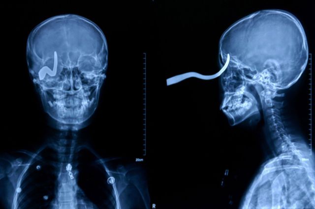 Real X-Rays That Will Shock and Astound You