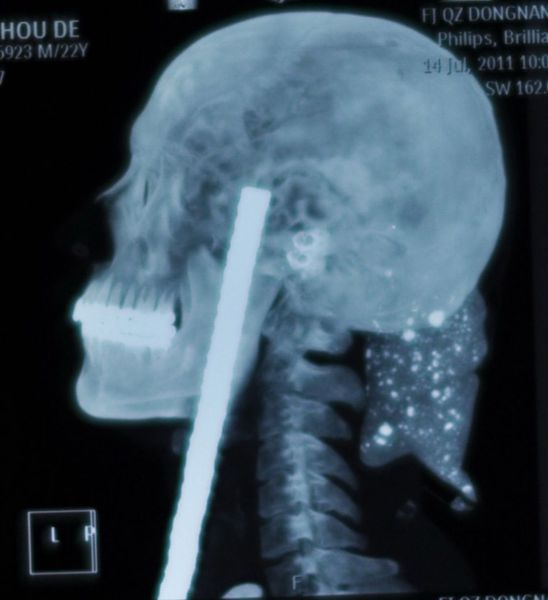 Real X-Rays That Will Shock and Astound You