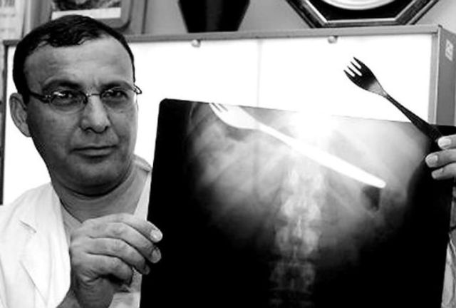 The Most Bizarre Items That Have Gotten Stuck in People’s Bodies