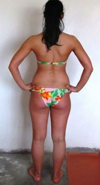 Remarkable Transformation of a Girl From Russia
