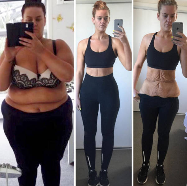 Weight Loss Success Stories